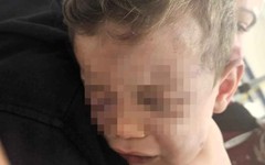 2 yaşındaki bebeği döverek hastanelik ettiler; Bebeğin bir gözü tehlikede