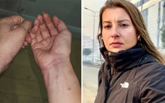 Gazeteci Neyran Elden’e kendi evinde polis şiddeti: Kelepçelendi, biber gazı sıkıldı, darp edildi