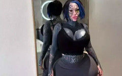 Aşırıya kaçan estetik operasyonlarıyla gündemdeydi: Fenomen hayatını kaybetti