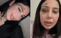 Sokakta vahşice dövülen Yağmur Serin'in acı öyküsü: Tecavüze uğradım hamile kaldım...