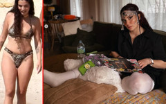 Doktor hatası yüzünden 6 kez ameliyat olan Aslı Bekiroğlu son halini paylaştı