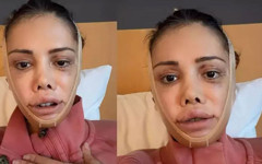Didem Ceran’ın 2 gün süren ameliyat sonrası son hali tartışma yarattı