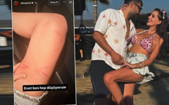 Dilan Polat Engin Polat'tan yediği dayağın izlerini paylaşıp sildi: Boşanacaksın oğlum benden