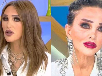 Seren Serengil Genç Kalmak İçin Yeni Doğan Bebeğin Sünnet Derisini...