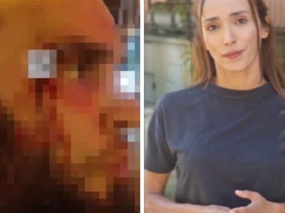 Tacizciyi Evire Çevire Dövmüştü, Feray Açıkgöz: Bu Defa Çok Sert Kayaya Çarptı