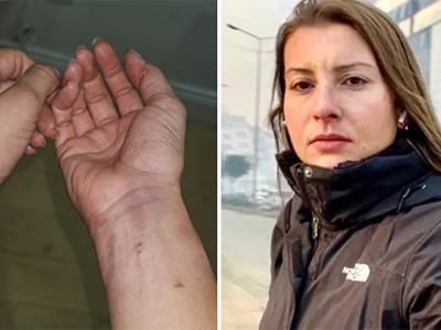 Gazeteci Neyran Elden’e kendi evinde polis şiddeti: Kelepçelendi, biber gazı sıkıldı, darp edildi