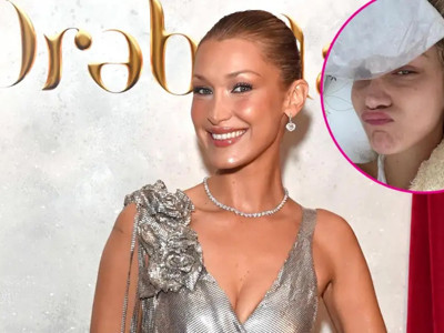 Dünyaca ünlü mankenin sağlık durumu endişe yarattı