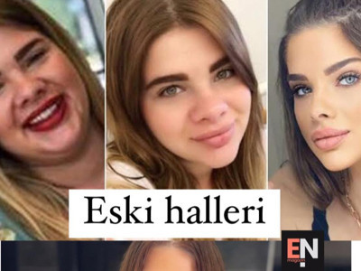 Oyuncu Damla Ersubaşı 41 kilo verdi, estetik yaptırdı, bambaşka bir kadın oldu: İşte son hali