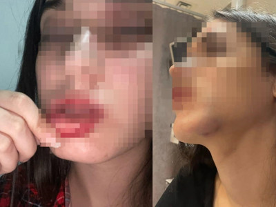 Eski sevgili dehşetini yaşayan Belinay Ceren sosyal medyadan yardım istedi