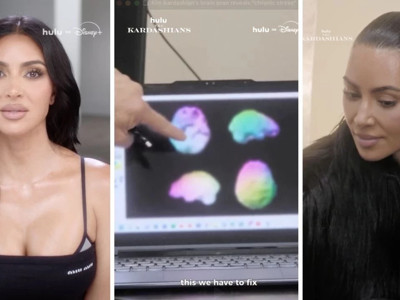 Kim Kardashian beyin taramasından geçti: Sonuca inanamadı