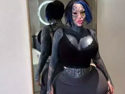 Aşırıya kaçan estetik operasyonlarıyla gündemdeydi: Fenomen hayatını kaybetti