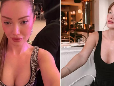 Danla Bilic :Göğüslerimdeki 450 cc’lik implantları çıkarttırdım