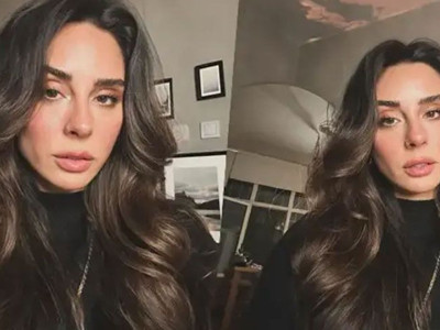 Yasemin Yürük talihsiz kazayı anlattı: Bacağı kırıldı, platin takıldı