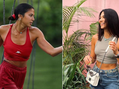 Survivor Gizem Memiç’ten üzen açıklama: Dizim hâlâ iyileşmedi