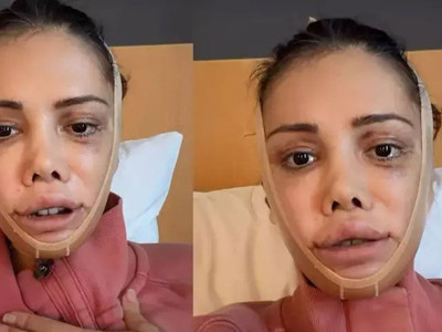 Didem Ceran’ın 2 gün süren ameliyat sonrası son hali tartışma yarattı