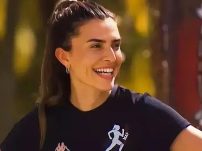 Survivor Merve Aydın yüzündeki değişimi paylaştı