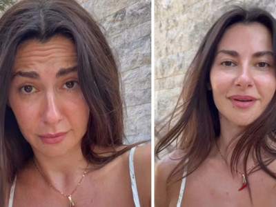 Nesrin Cavadzade botoks iddialarına isyan etti: Belki hastayım, belki çocuk bekliyorum