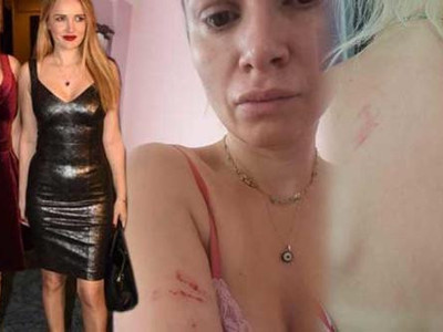 Seçkin Piriler ile Meral Kaplan kavgasının fotoğrafları ortaya çıktı!