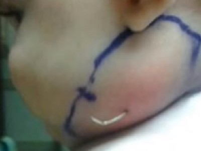 Bebeklerinin yüzünde geçmeyen kızarıklık! Bebekten çıkana doktor inanamadı