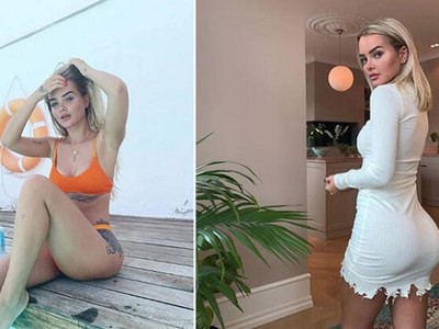 Norveçli Sophie Elise Türkiye’de ucuza estetik yaptırdı, kalçası kaydı