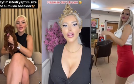 TikTok fenomeni Pınar Özkurteller kaç estetik ameliyat yaptırdığını açıkladı: Şok geçireceksiniz