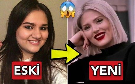 TikTok fenomeni Aybüke Çangal estetik harikası çıktı: Aybüke Çangal'ın gamzeleri bile doğal değilmiş