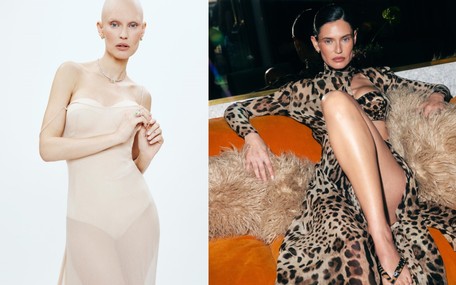Yumurtalık kanseri olan Victoria's Secret modeli Bianca Balti son görüntüsüyle üzdü