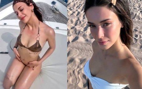 Devrim Özkan zor günler geçiriyor! İkinci kez ameliyat oldu