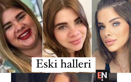 Oyuncu Damla Ersubaşı 41 kilo verdi, estetik yaptırdı, bambaşka bir kadın oldu: İşte son hali