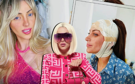 Barbie'ye benzemek istedi: 27 ameliyatla canından oldu