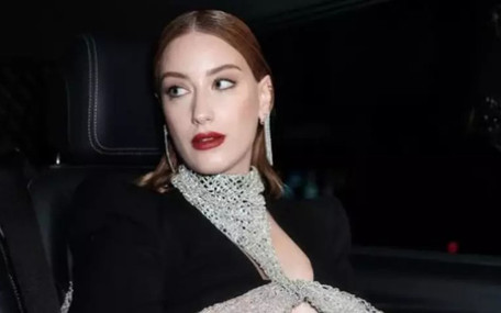 Hazal Kaya’nın yüzündeki değişim olay oldu! Diş estetiği eleştirildi