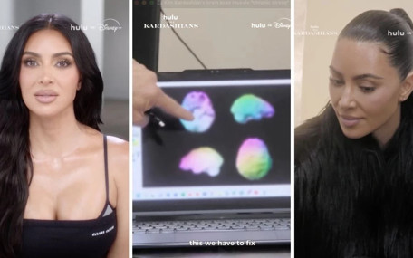 Kim Kardashian beyin taramasından geçti: Sonuca inanamadı