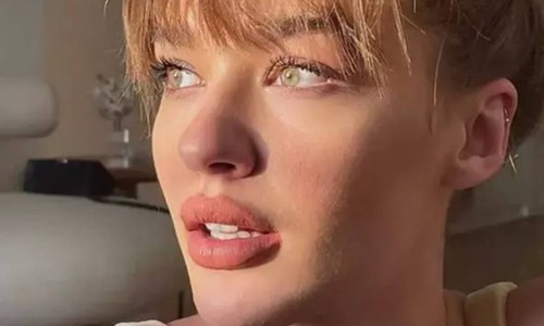 Ünlü oyuncu Melisa Döngel'in estetiksiz hali ortaya çıktı