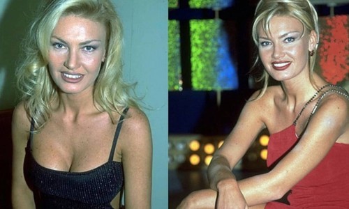 Model Yasemin Koşal yıllar sonra gündem oldu