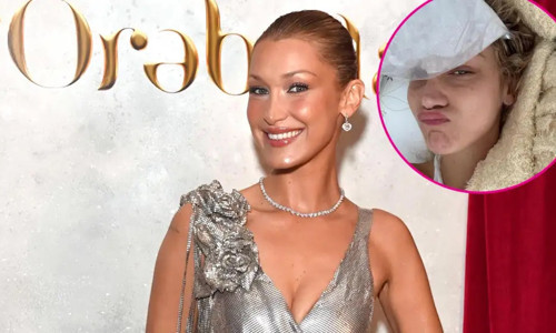 Dünyaca ünlü mankenin sağlık durumu endişe yarattı