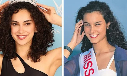 Yeni Türkiye güzeli sosyal medyayı salladı: Arzum Onan’ın kopyası