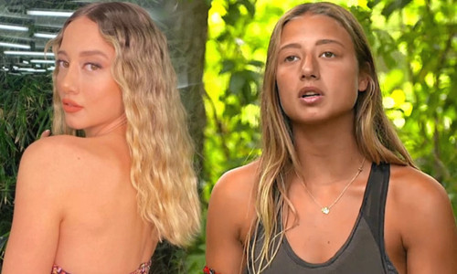 Survivor’ın Aleyna’sı estetik sonrası görünümüyle gündemde