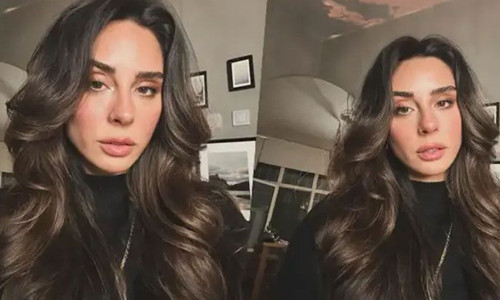 Yasemin Yürük talihsiz kazayı anlattı: Bacağı kırıldı, platin takıldı