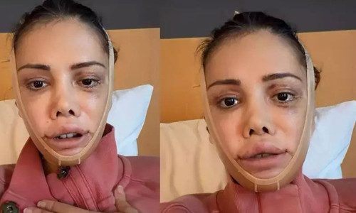 Didem Ceran’ın 2 gün süren ameliyat sonrası son hali tartışma yarattı