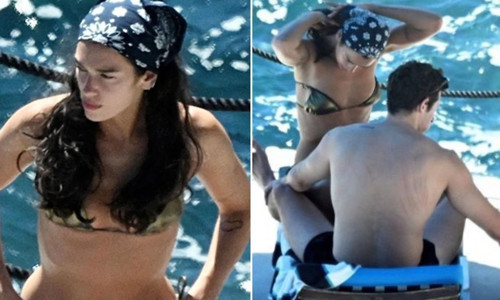 Dua Lipa'nın eşi Callum Turner'ın sırtındaki çizikler sosyal medyada gündem oldu