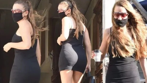 Serenay Sarıkaya'nın Kalçası Çok Konuşuldu,  Estetik mi Oldu?