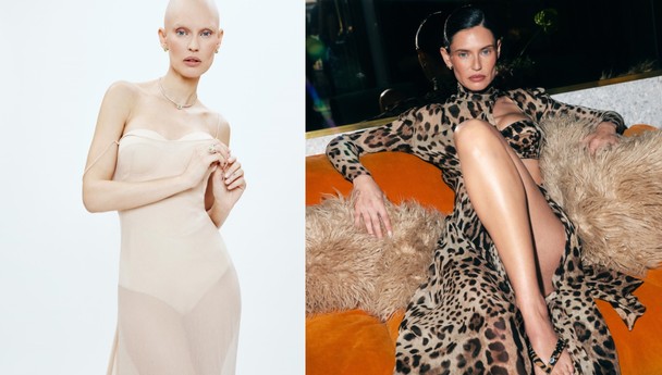 Yumurtalık kanseri olan Victoria's Secret modeli Bianca Balti son görüntüsüyle üzdü