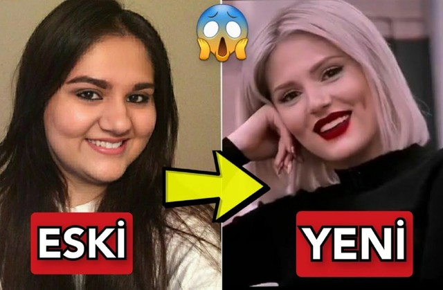 TikTok fenomeni Aybüke Çangal estetik harikası çıktı: Aybüke Çangal'ın gamzeleri bile doğal değilmiş