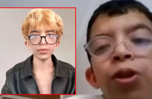 Sosyal medyada zorbalık, 5 yüz ameliyatı: Tablet Reis’in ağlatan değişim hikayesi