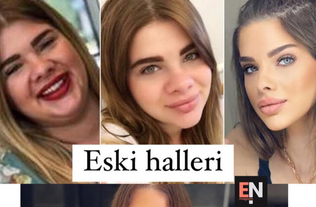 Oyuncu Damla Ersubaşı 41 kilo verdi, estetik yaptırdı, bambaşka bir kadın oldu: İşte son hali