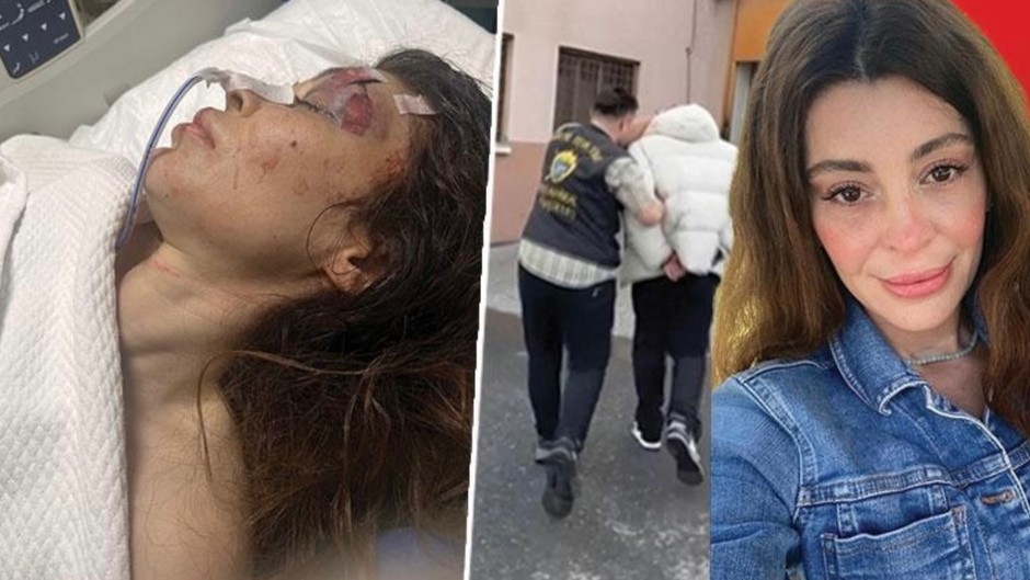 Beşiktaş'ta şikayet ettiği spor salonu sahibi tarafından bıçaklanan Sibel yaşam mücadelesi veriyor