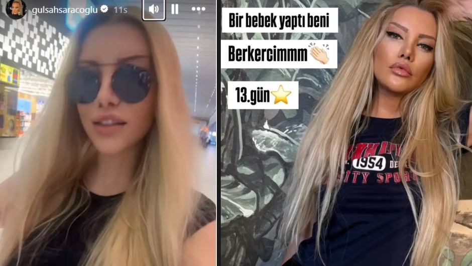 Gülşah Saraçoğlu pasaport kontrolünden geçemedi: O kadar çok estetik yaptırmış ki polis tanımadı