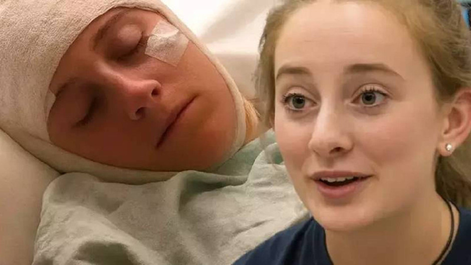 Okul balosunda beyin sarsıntısı geçirdi, şimdi hafızası her 2 saatte bir siliniyor