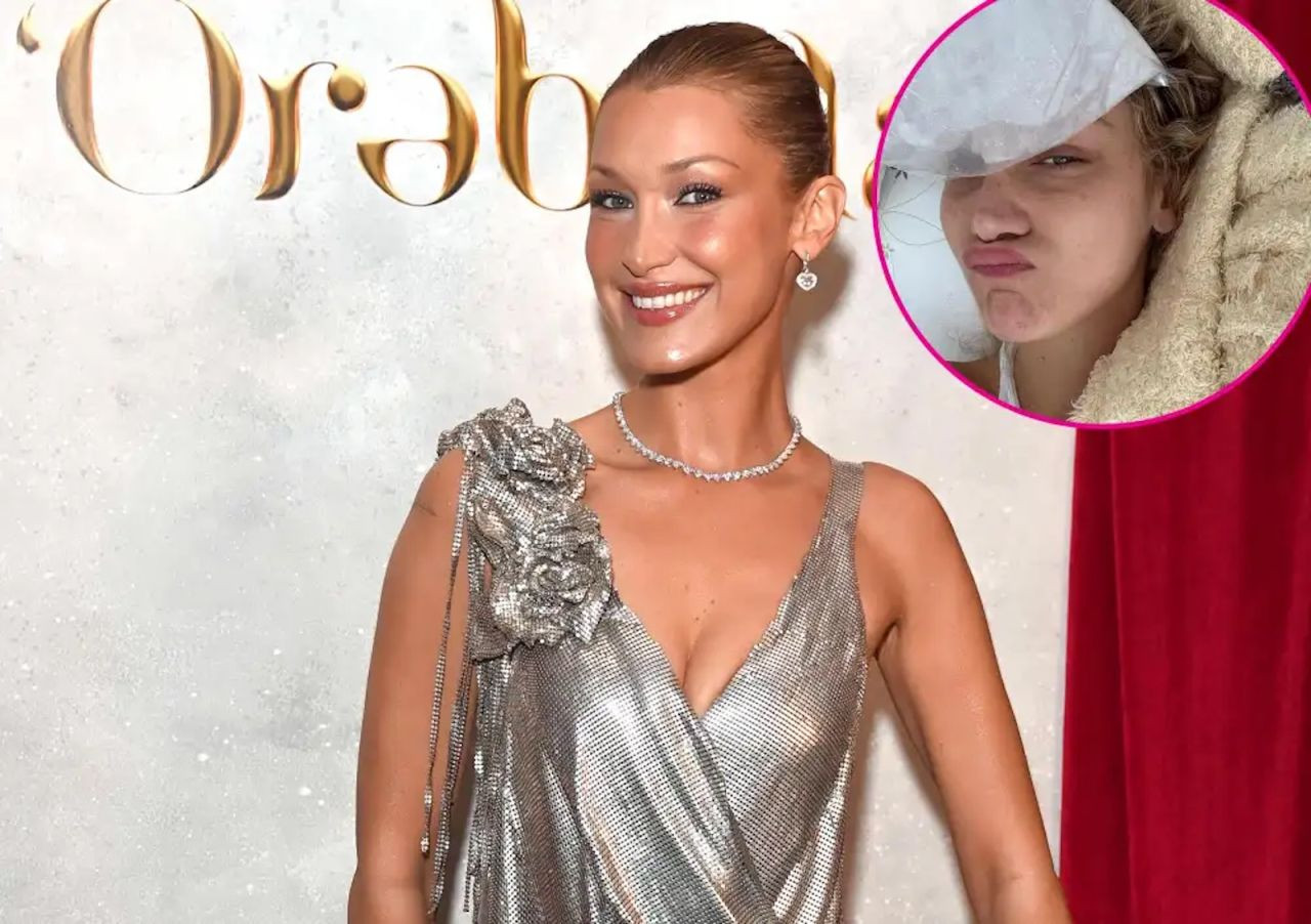 Dünyaca ünlü mankenin sağlık durumu endişe yarattı - Resim: 1