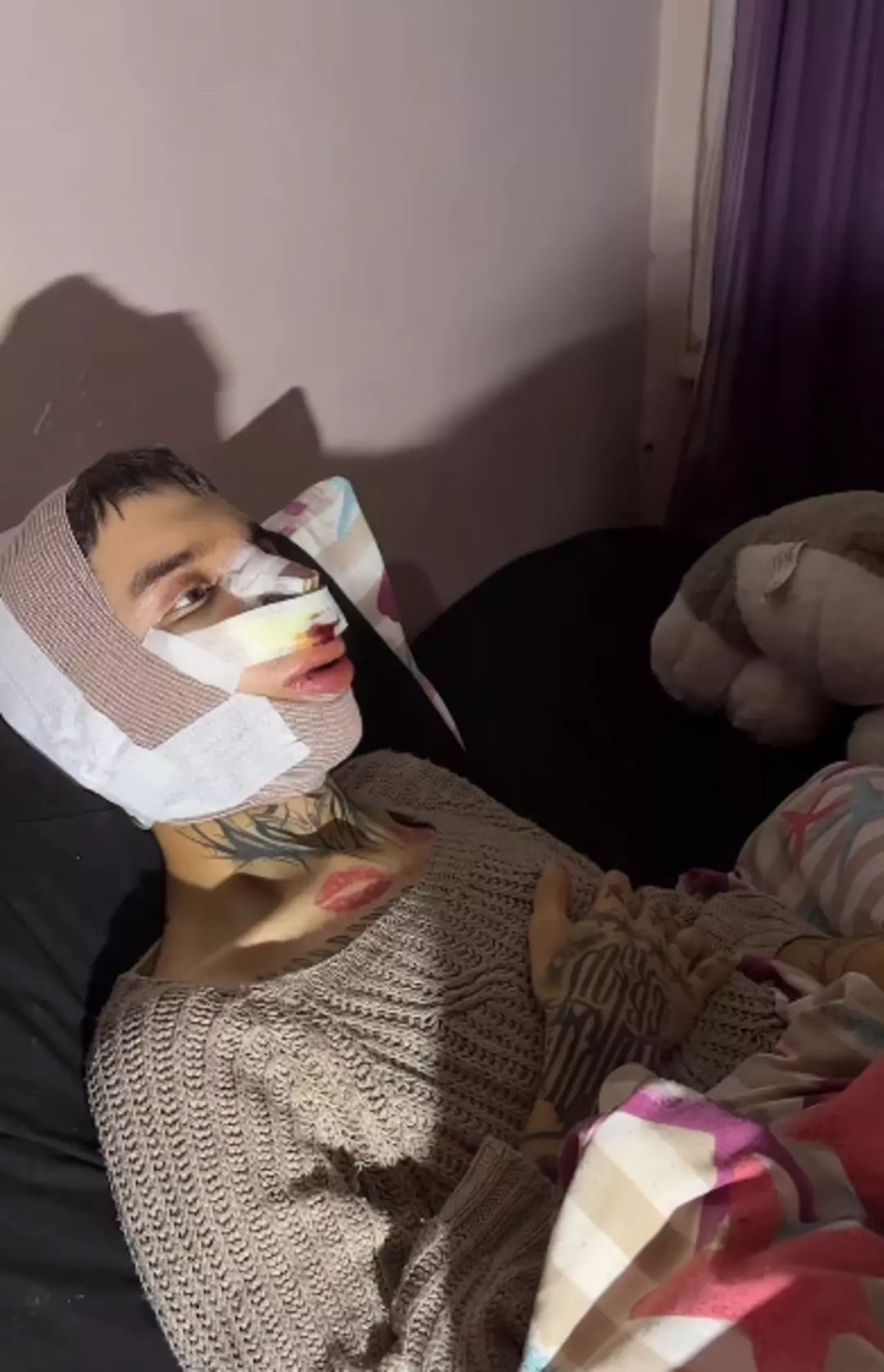 Sosyal medyada zorbalık, 5 yüz ameliyatı: Tablet Reis’in ağlatan değişim hikayesi - Resim: 4